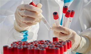 初步投入31亿美元联合国要建全球气候预警系统(图4)